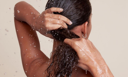 Should I Wash My Head More Or Less With Seborrheic Dermatitis or Oily Dandruff?